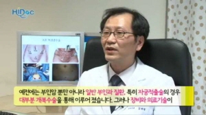 부인암 복강경수술