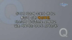 대상포진