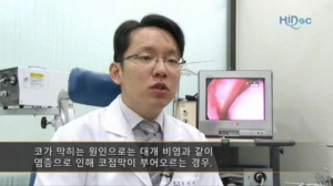 코막힘과 비중격 만곡증 치료법!
