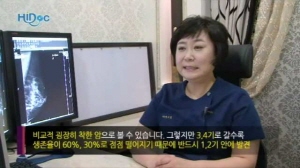 여성암 검진에 관한 궁금증