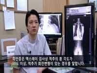 특발성 척추측만증