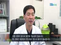대장내시경에 대한 모든 것