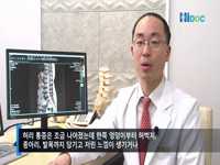 다리가 당기고 저리다면? 알고 보니 허리디스크!