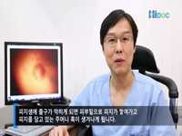 피부가 있는 곳이라면 어디든지 생길 수 있는 피지낭종