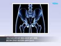 남녀 모두 효과적인 케겔운동법, ‘3·3’ 10번씩 하루 3회하기